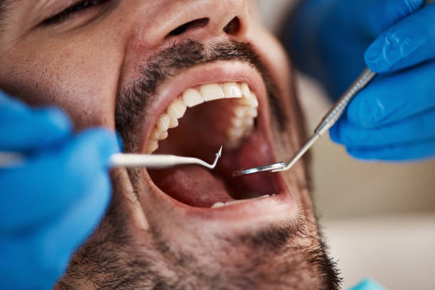 Best Emergency Dental Services for Seniors in Thermalito, CA